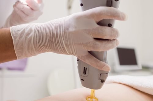 Close up of doctor performing laser hair removal on female patient skin in clinic