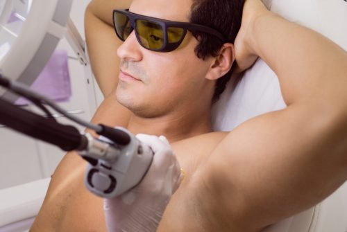 Doctor performing laser hair removal on male patient skin in clinic